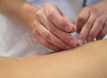 Akupunktur © kastro - Fotolia.com
